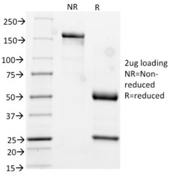 Cytokeratin 17 Antibody (KRT17/778), Novus Biologicals 0.2mg; Unlabeled:Antibodies,